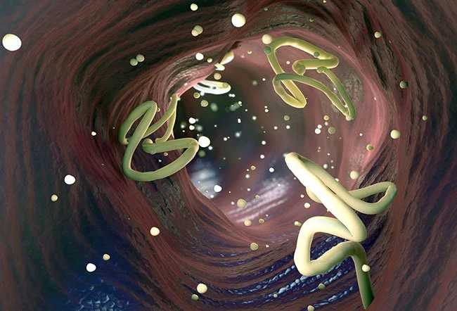 ascariasis-baqteria-wyalshi